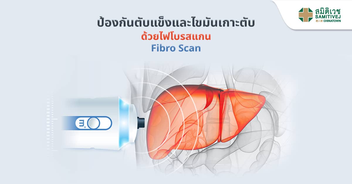 ป้องกันตับแข็งและไขมันเกาะตับด้วยไฟโบรสแกน (Fibro Scan) | โรงพยาบาล ...